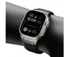 Apple Watch Ultra 49mm Zore KRD-113 Spor Görünümlü Silikon Kordon