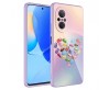 Huawei Nova 9 SE Kılıf Kamera Korumalı Desenli Sert Silikon Zore Epoksi Kapak