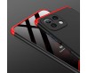 Xiaomi Mi 11 Lite Kılıf Zore Ays Kapak