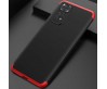 Xiaomi Redmi Note 11 Global Kılıf Zore Ays Kapak